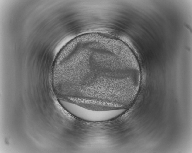 X0000099310952200805301151