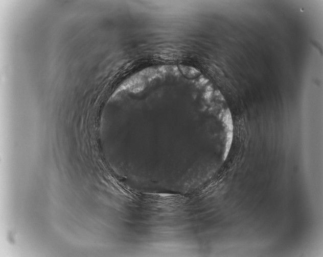 X0000099311009200805301149