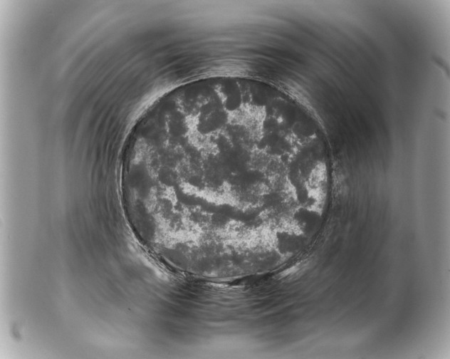 X0000099311035200805301150