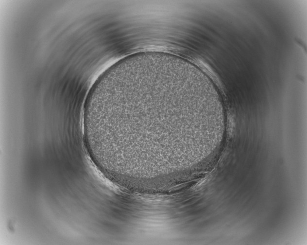 X0000099311036200805301150