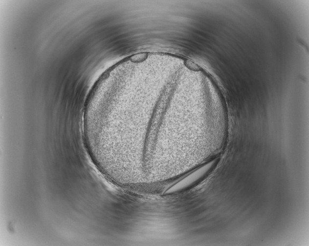 X0000099311040200805301150