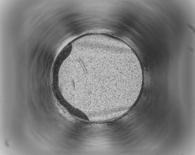 X0000099311044200805301150