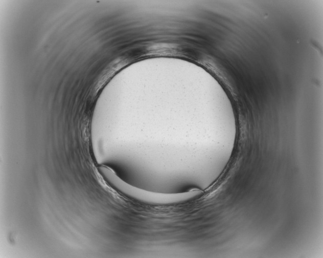 X0000099311049200805301150