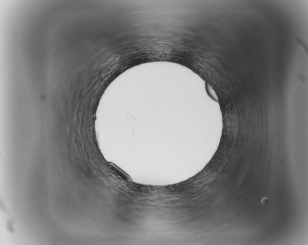 X0000099311057200805301149