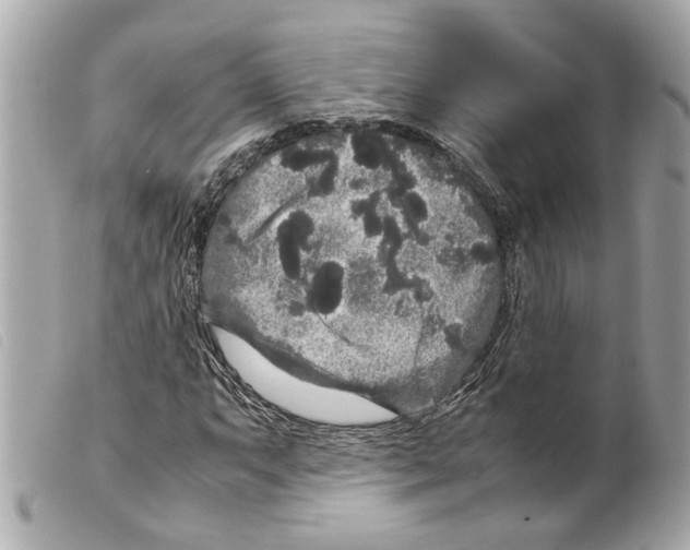 X0000099311063200805301149