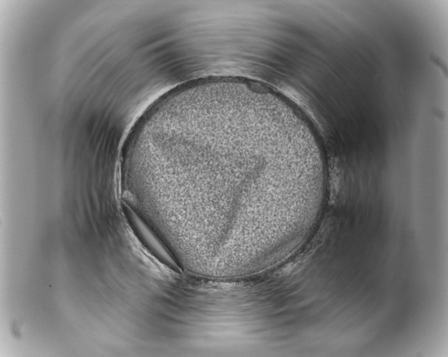 X0000099311076200805301149