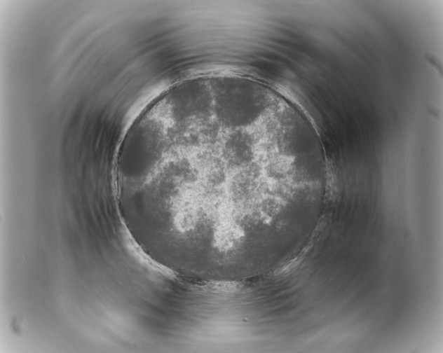 X0000099311090200805301149