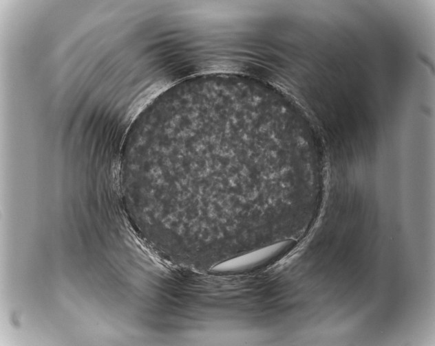 X0000099311121200805301148