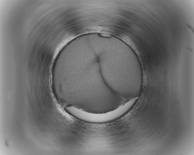 X0000099311136200805301149