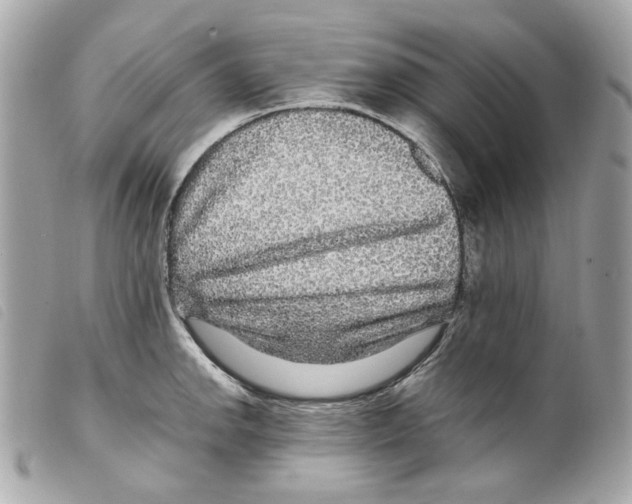 X0000099311142200805301149