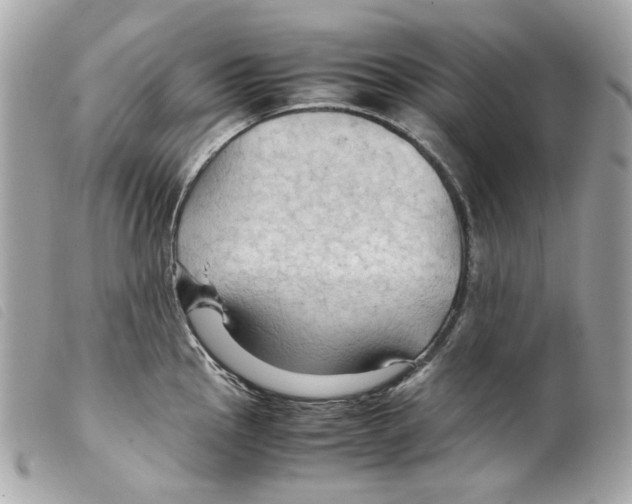 X0000099311145200805301149