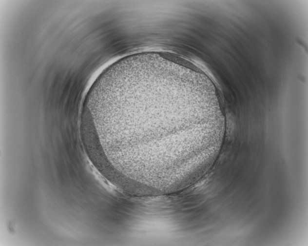 X0000099311148200805301149