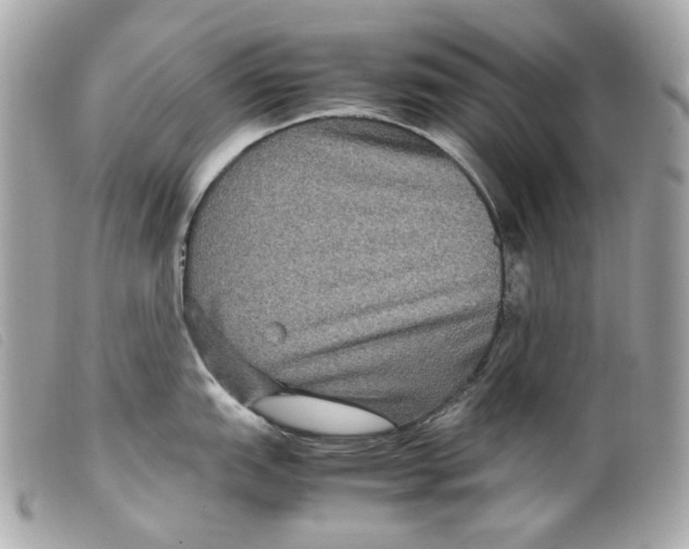 X0000099311151200805301149