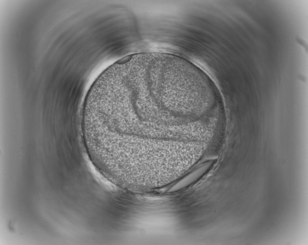 X0000099311152200805301149