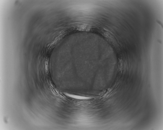 X0000099311154200805301148