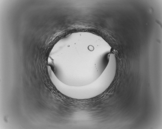 X0000099311157200805301148