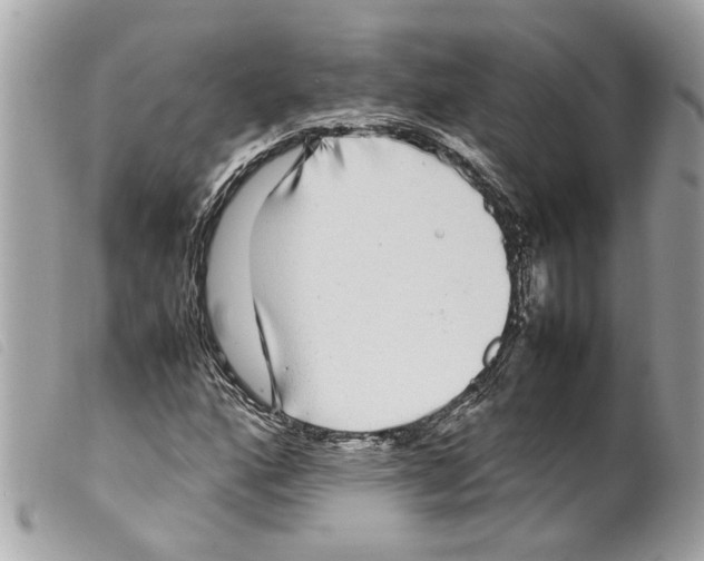 X0000099311160200805301148