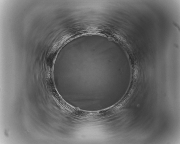 X0000099311161200805301148