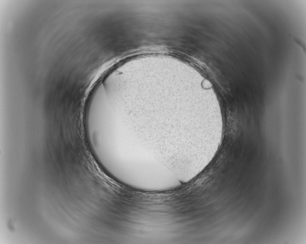 X0000099311168200805301148