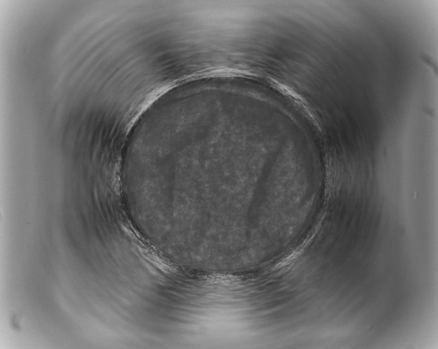 X0000099311170200805301148