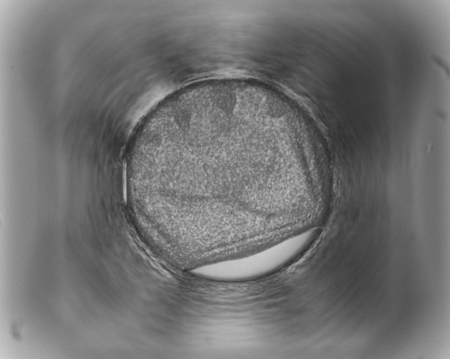 X0000099311171200805301148