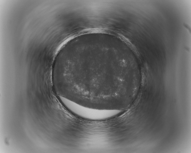 X0000099311174200805301148