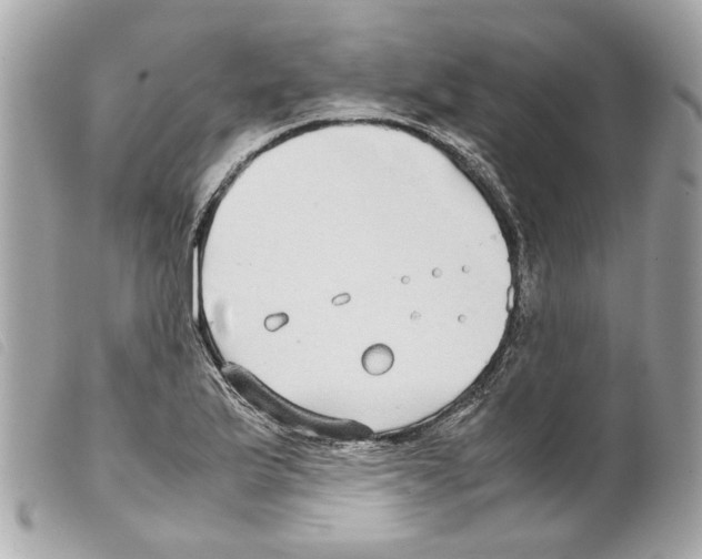 X0000099311175200805301148