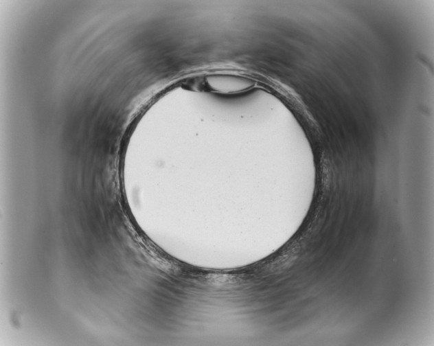 X0000099311176200805301148