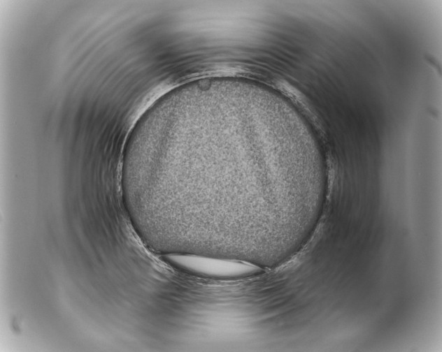 X0000099311178200805301148