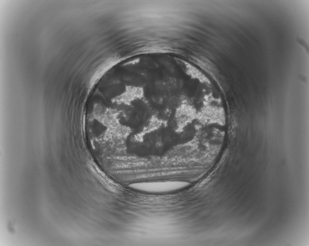 X0000099311179200805301148