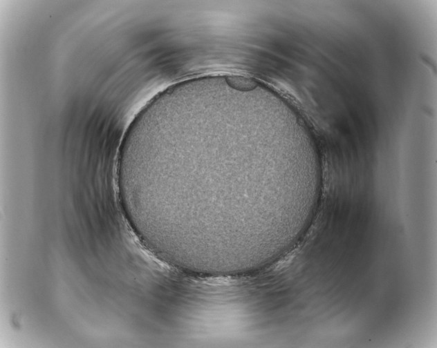 X0000099311182200805301148