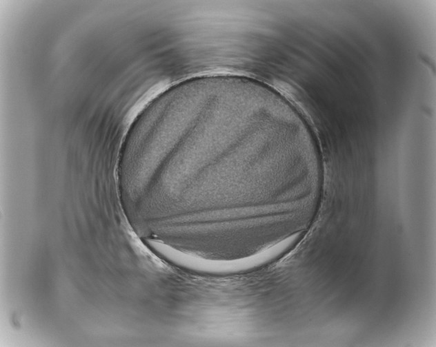 X0000099311189200805301148