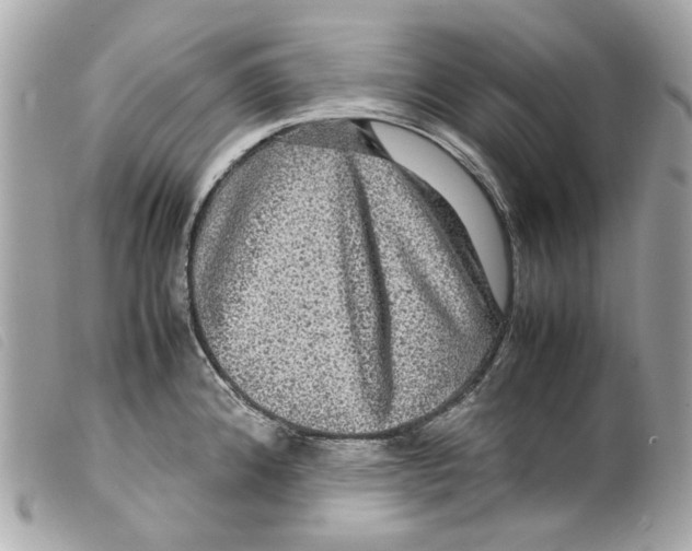 X0000099311192200805301148