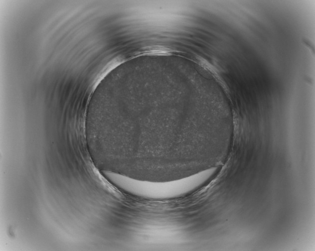 X0000099311194200805301148