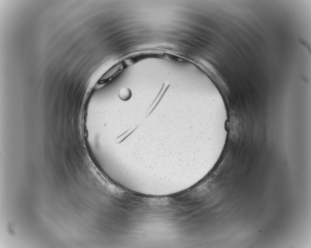 X0000099311196200805301148