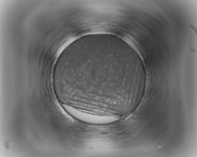 X0000099311197200805301148