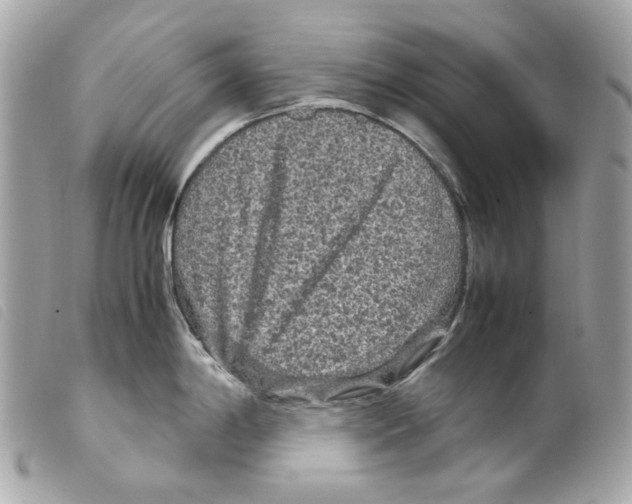 X0000099311198200805301148