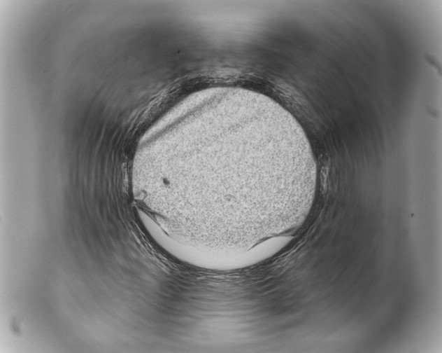 X0000099311204200805301147