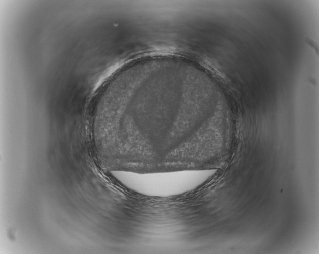 X0000099311208200805301147