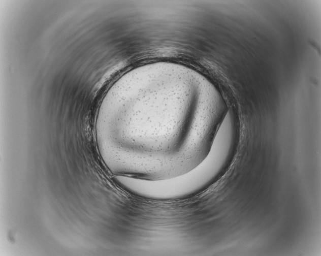 X0000099311210200805301147