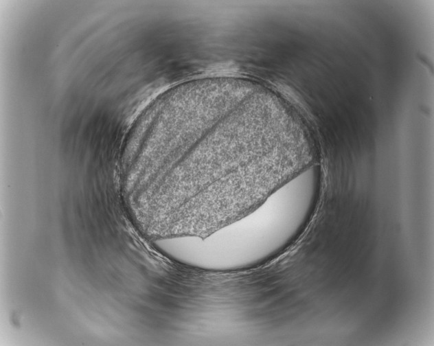 X0000099311212200805301147