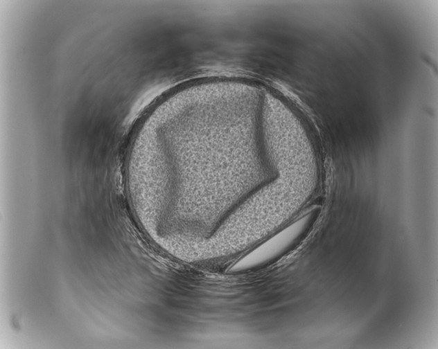 X0000099311215200805301147