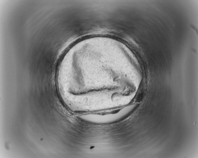 X0000099311216200805301147