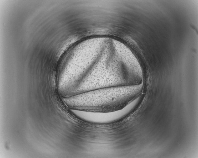 X0000099311218200805301147