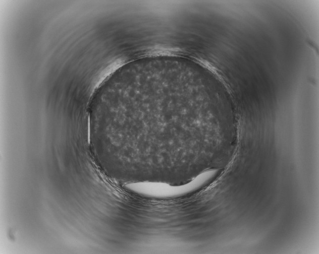 X0000099311219200805301147