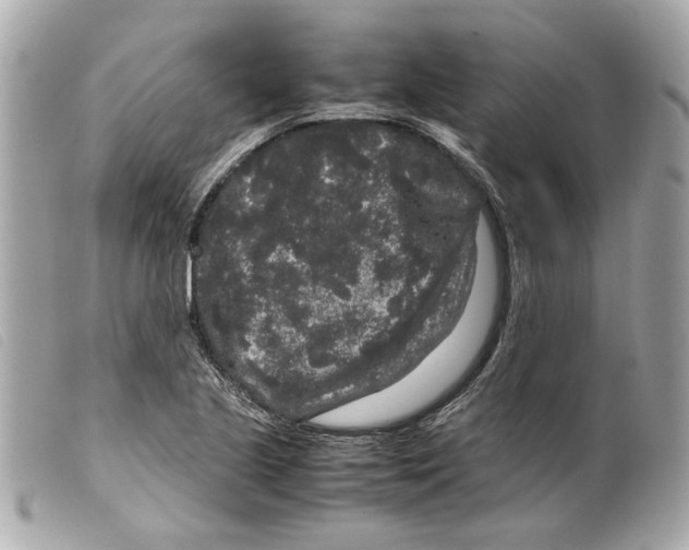 X0000099311221200805301147