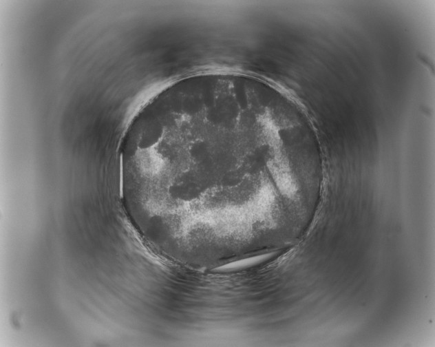 X0000099311223200805301147