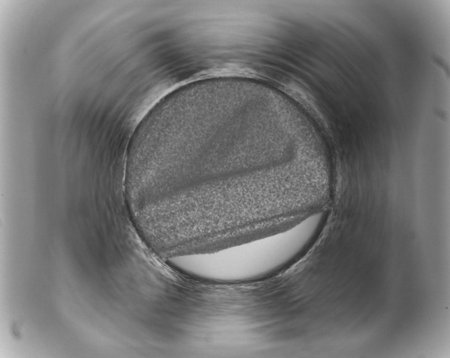 X0000099311228200805301147