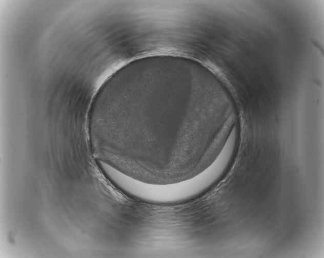 X0000099311230200805301147