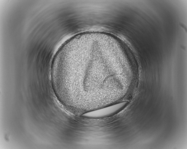 X0000099311232200805301147